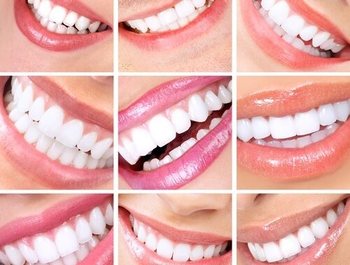 Cosmetic-Dentistry-2