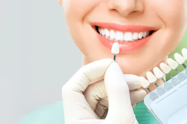 Cosmetic-Dentistry