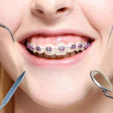 Orthodontic